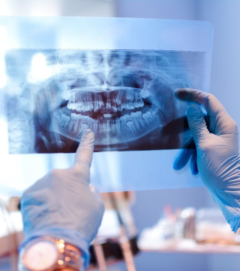 Examination Of Diagnostic X-rays