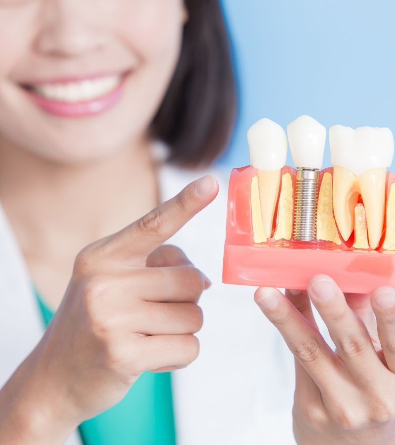Dentist Showing Dental Implants Sample